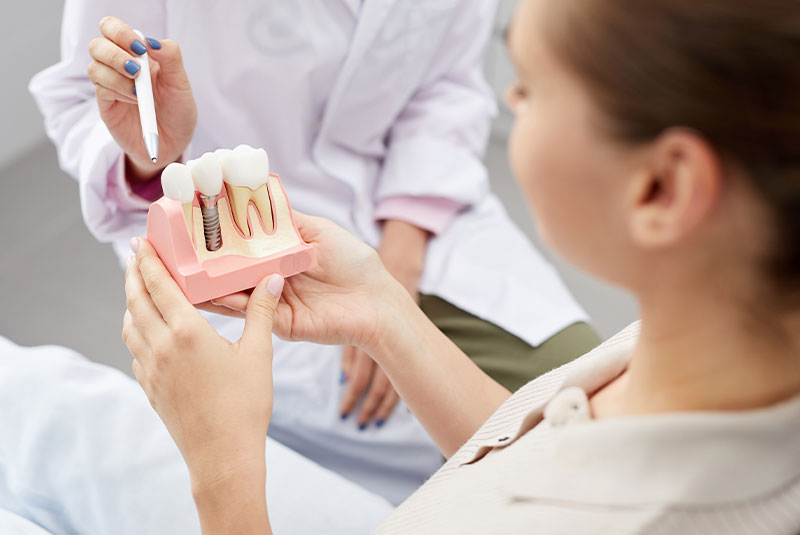 showing a dental implant in office