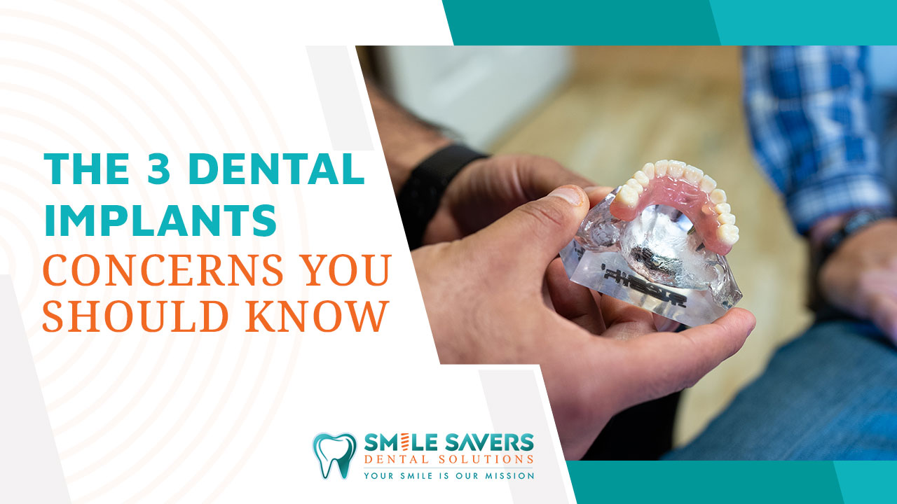 mv 3 reasons dental implants